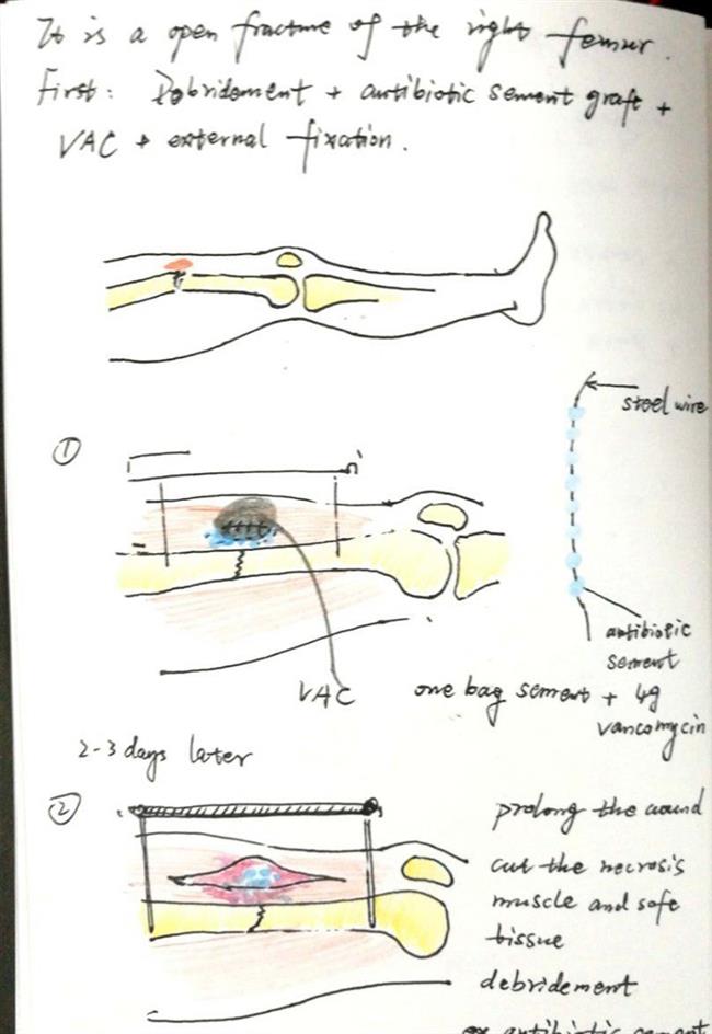 Doctor draws pictures to explain operations to confused patients and families