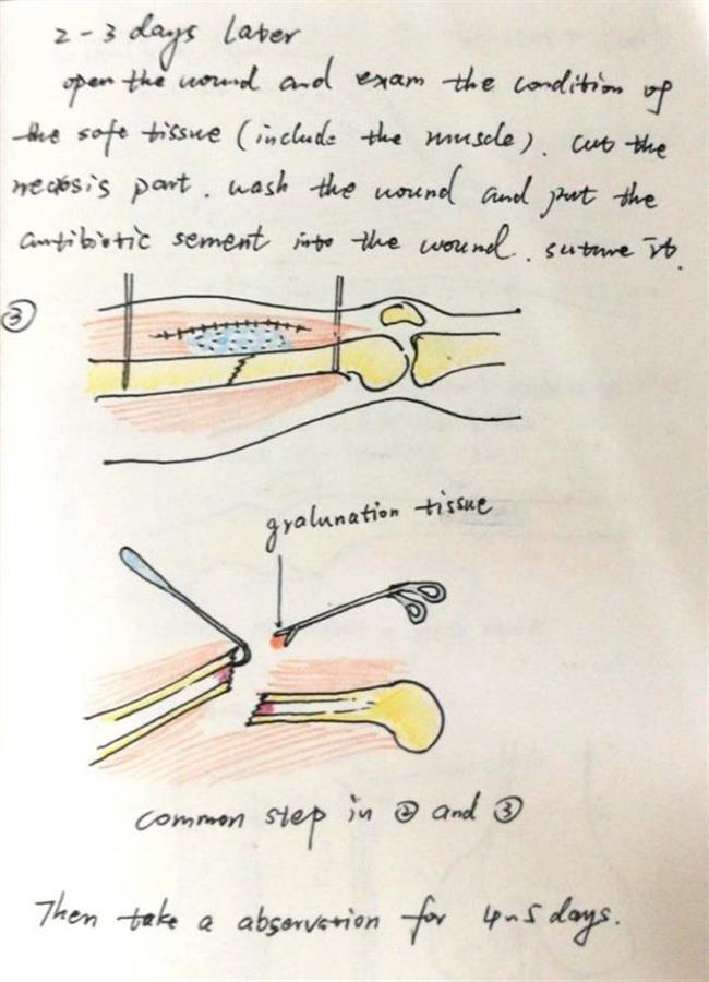 Doctor draws pictures to explain operations to confused patients and families