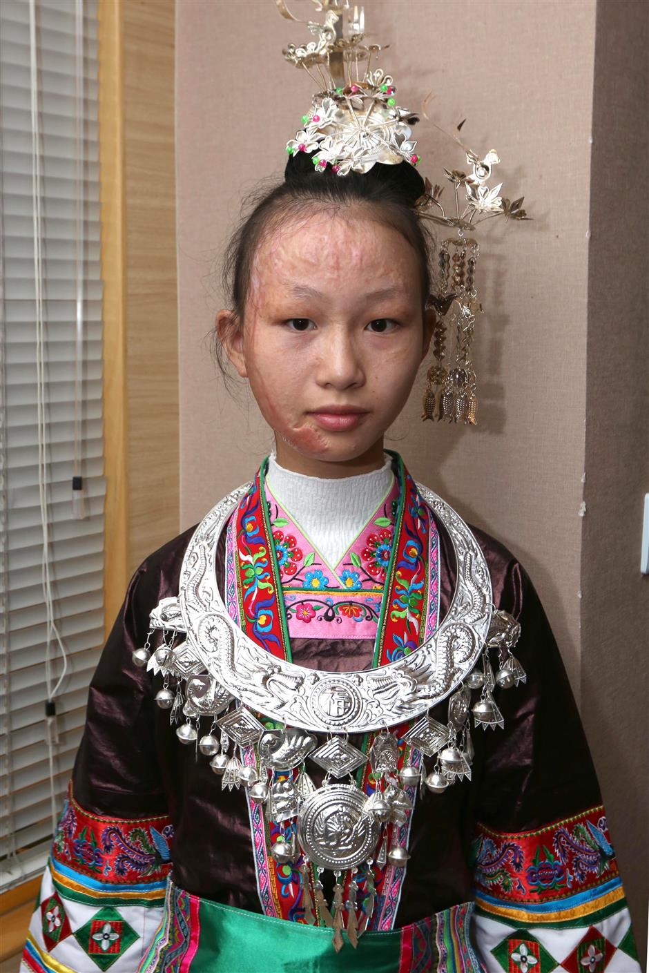 Young girl begins free treatment for facial burns