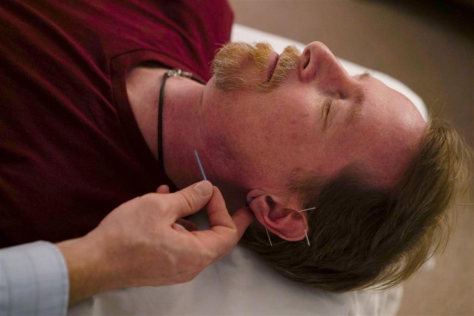 Acupuncture new weapon in fighting US opioid crisis