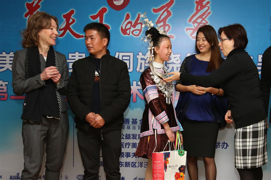 Guizhou teen to receive free facial burns surgery