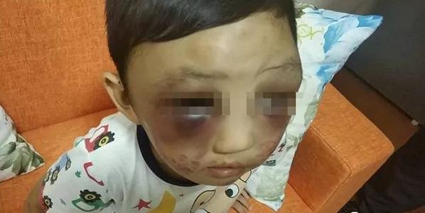 Single mother detained for abusing son