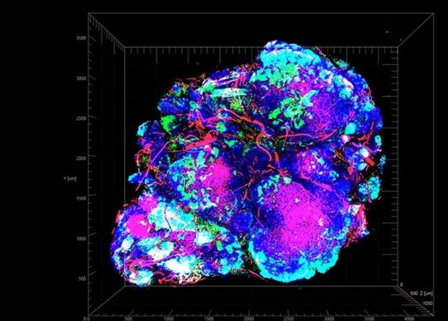 Scientists suggest a new tactic for starving tumors