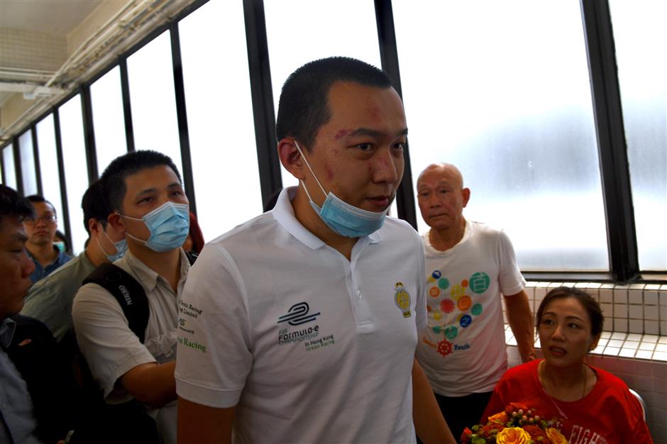 Hong Kong residents visit injured reporter, call for end of violence