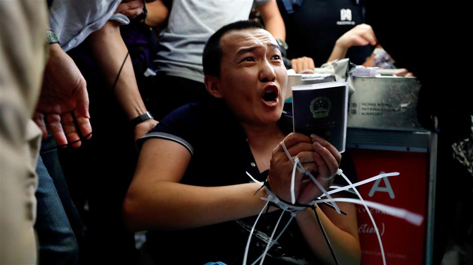 Hong Kong residents visit injured reporter, call for end of violence