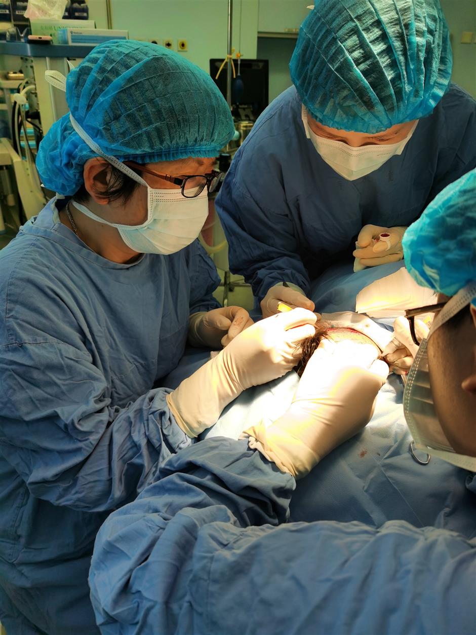 Hair-follicle transplants become more common remedy for hair loss