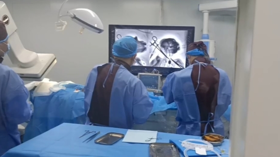 China completes world's first interventional BCI experiment on non-human primates - Vimarsana News