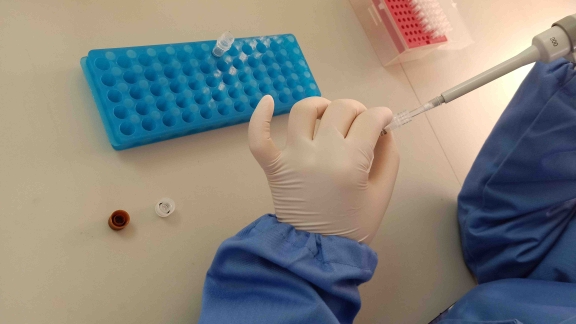 Home pathogen testing available in Shanghai - City News Service