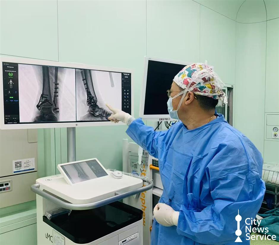 Shanghai hospital pioneers innovative fracture material