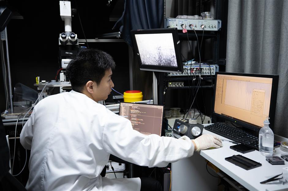 [China Tech] Local brain science experts making new progress