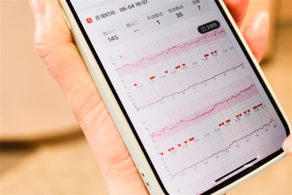 [Health Byte] Inside Shanghai's New Era of Maternity Care
