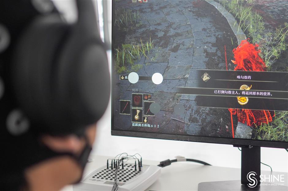 [Health Byte] Sci-fi SH is developing brain-computer interface