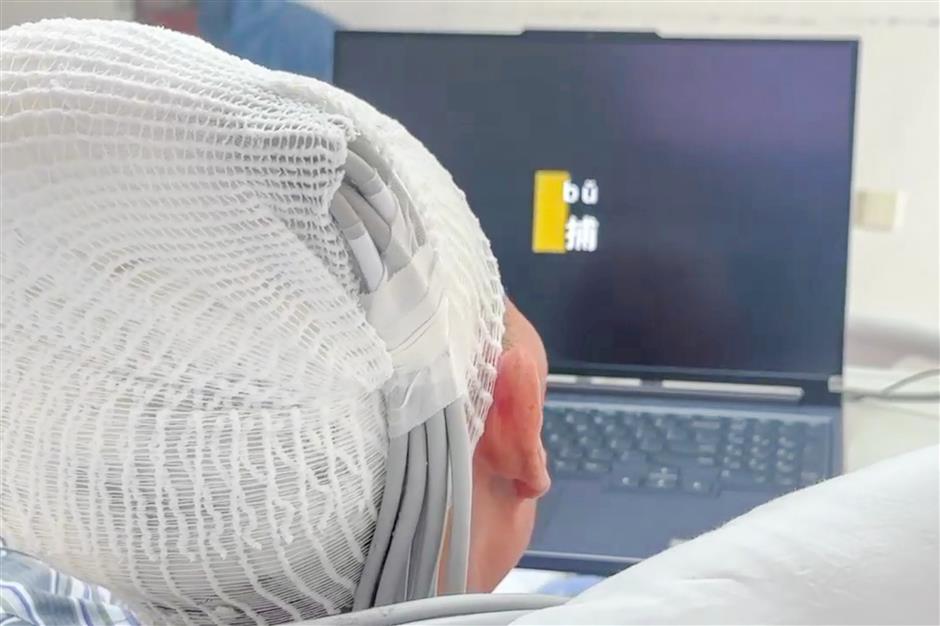 [Health Byte] Sci-fi SH is developing brain-computer interface