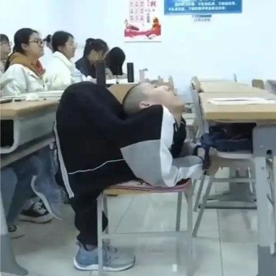 China's 'folded boy' stands straight after groundbreaking ops