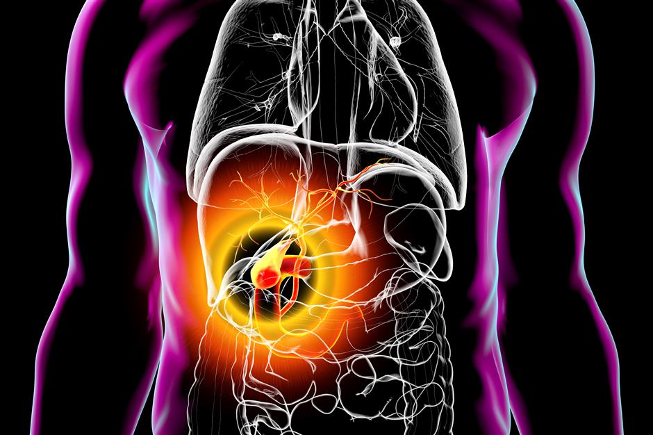 [China Tech] Local Doctors Develop Innovative Therapy For Cancer of the Biliary Duct