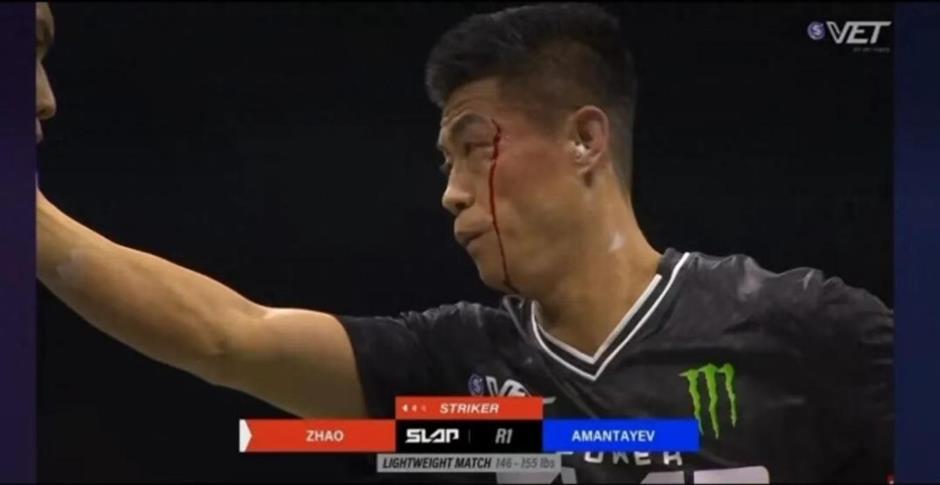 The Slap Heard Across China: Zhao Honggang's Painful Rise to Fame