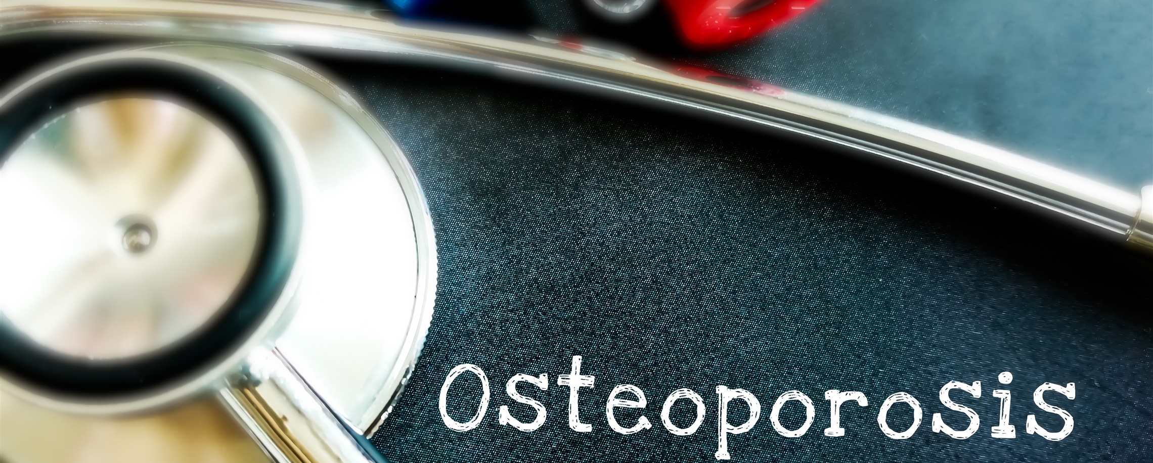 [China Tech] Shanghai Bone Doctors Find Cause of Osteoarthritis