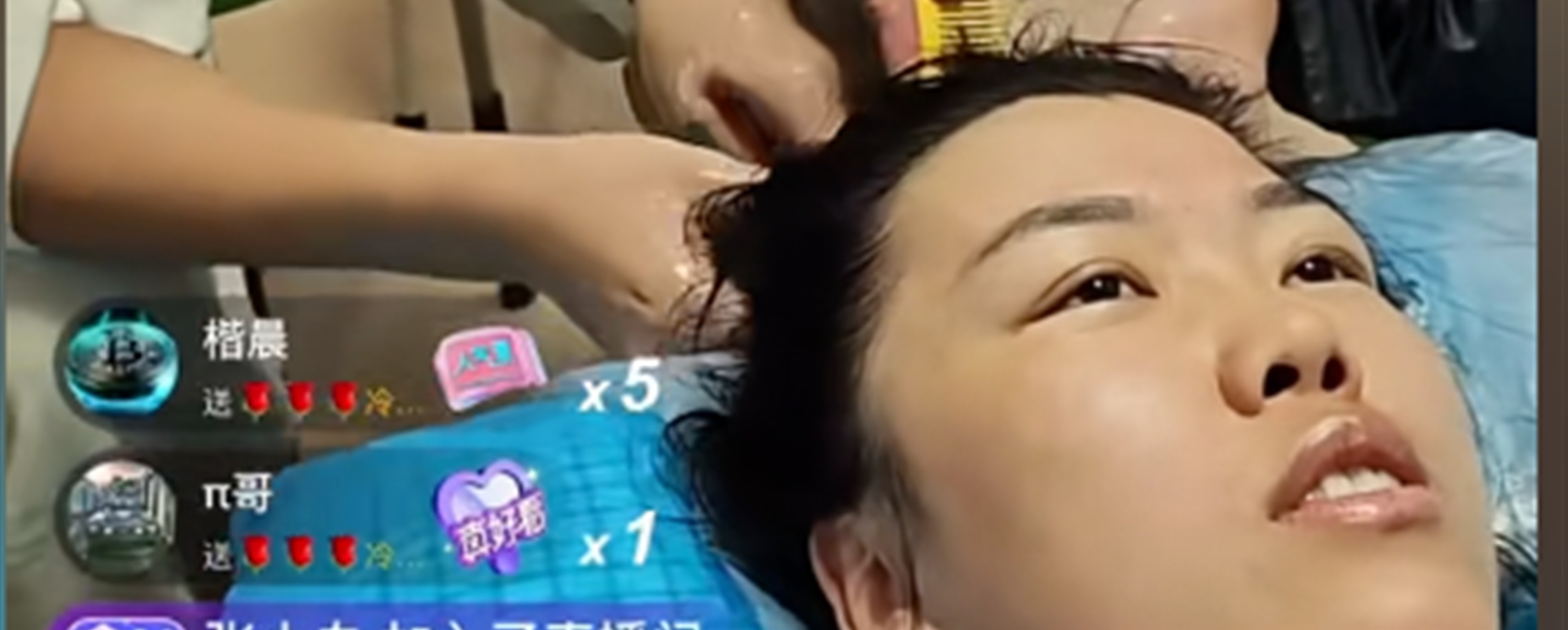 'Cold Beauty's Hospital Hair-Wash Goes Viral after Survival Race