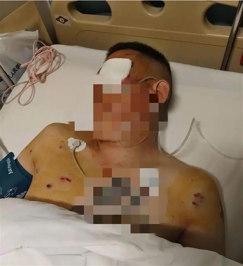 Man With Suitcase of 1.7m Yuan Attacked by Gunman Outside Bank