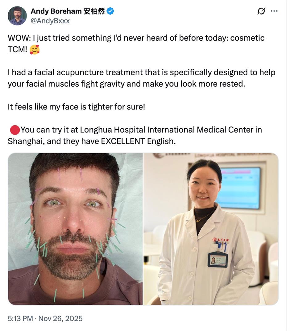 [Health Byte] Can Acupuncture Make You Beautiful and Slimmer?