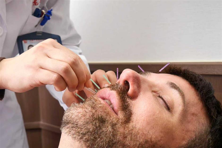 [Health Byte] Can Acupuncture Make You Beautiful and Slimmer?