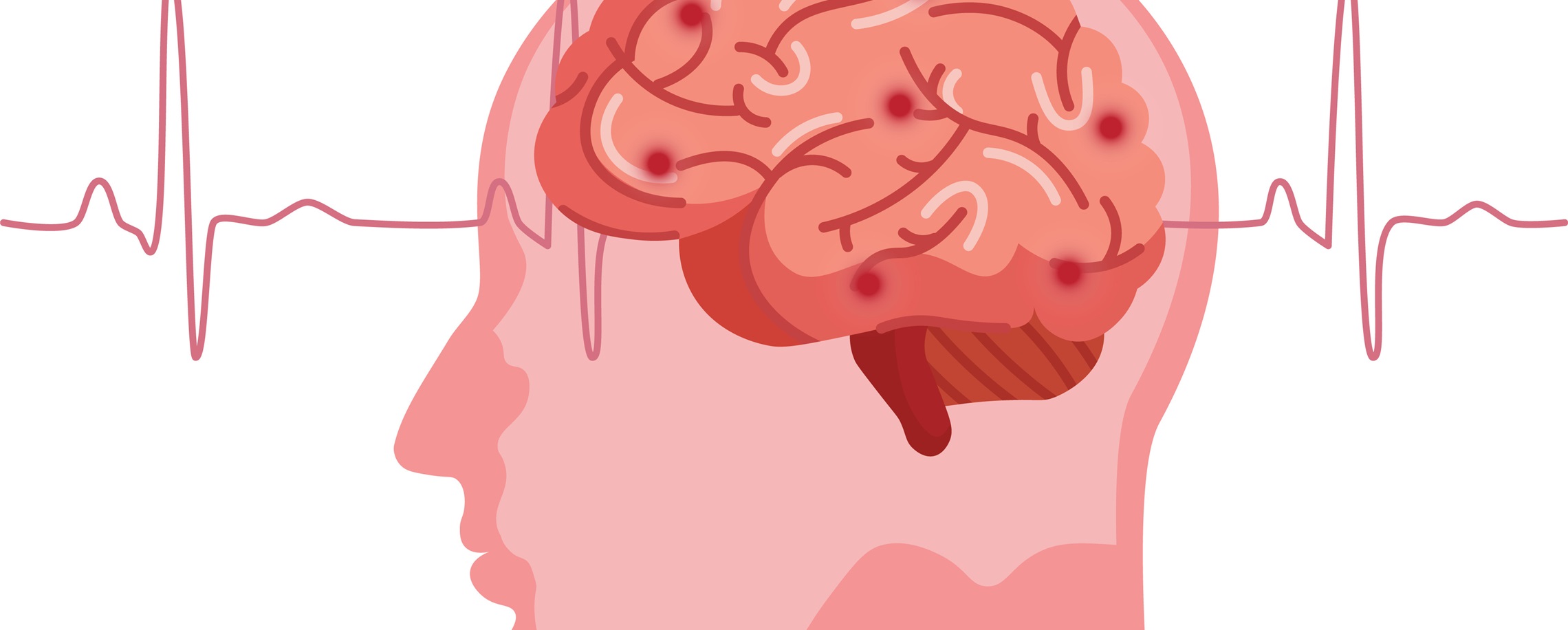 [Experts & Ailment] Combined Western and Chinese Therapy Saves a Shipboard Stroke Victim From Croatia