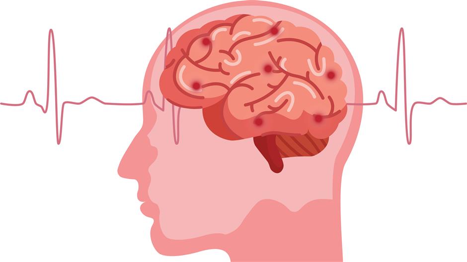 [Experts & Ailment] Combined Western and Chinese Therapy Saves a Shipboard Stroke Victim From Croatia