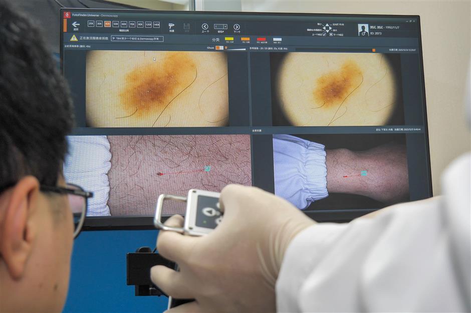 [Health Byte] That Mole You Have Might Be Cancer...