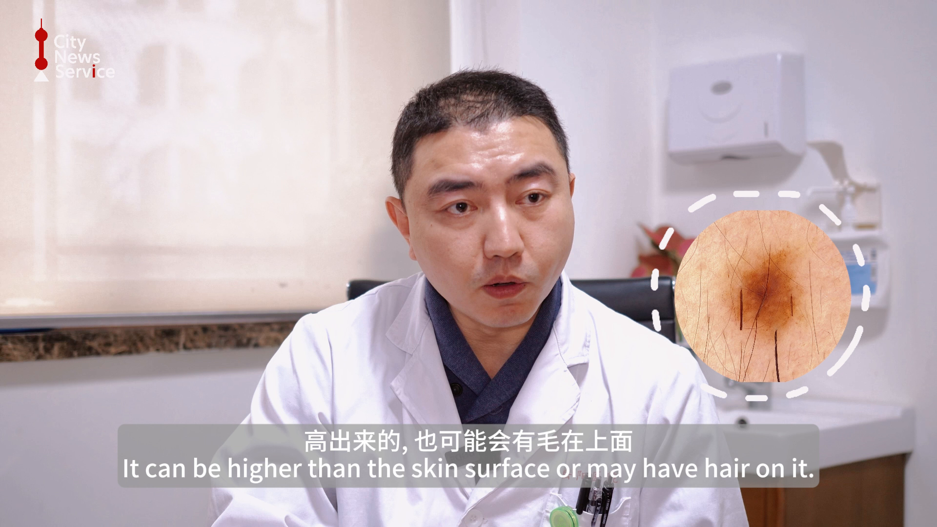 [Health Byte] That Mole You Have Might Be Cancer...