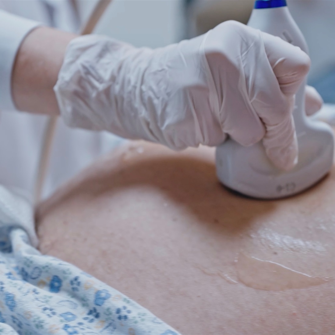 [China Tech] Breakthrough in Study Offers Hope for Unexplained Recurrent Miscarriages