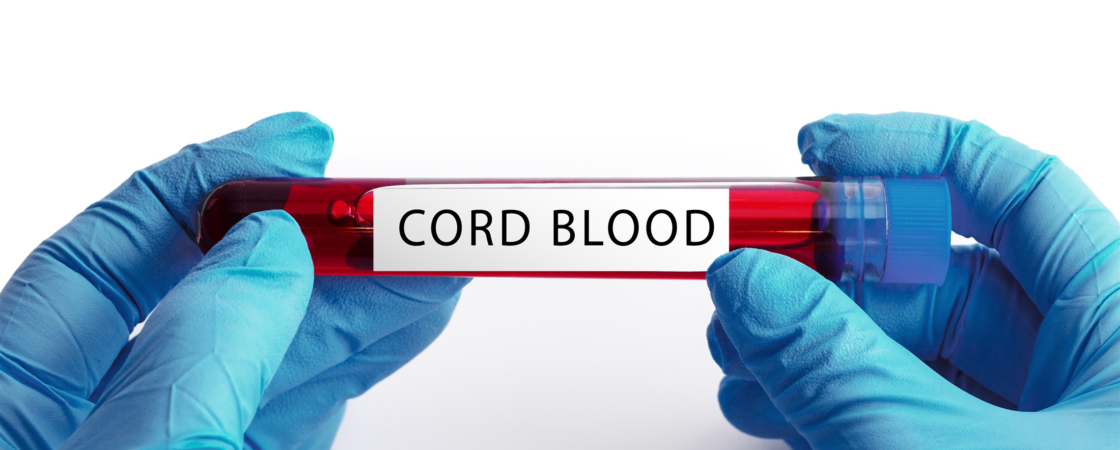[China Tech] Shanghai Cord Bank Reaches Milestone with 8,000 Transplants