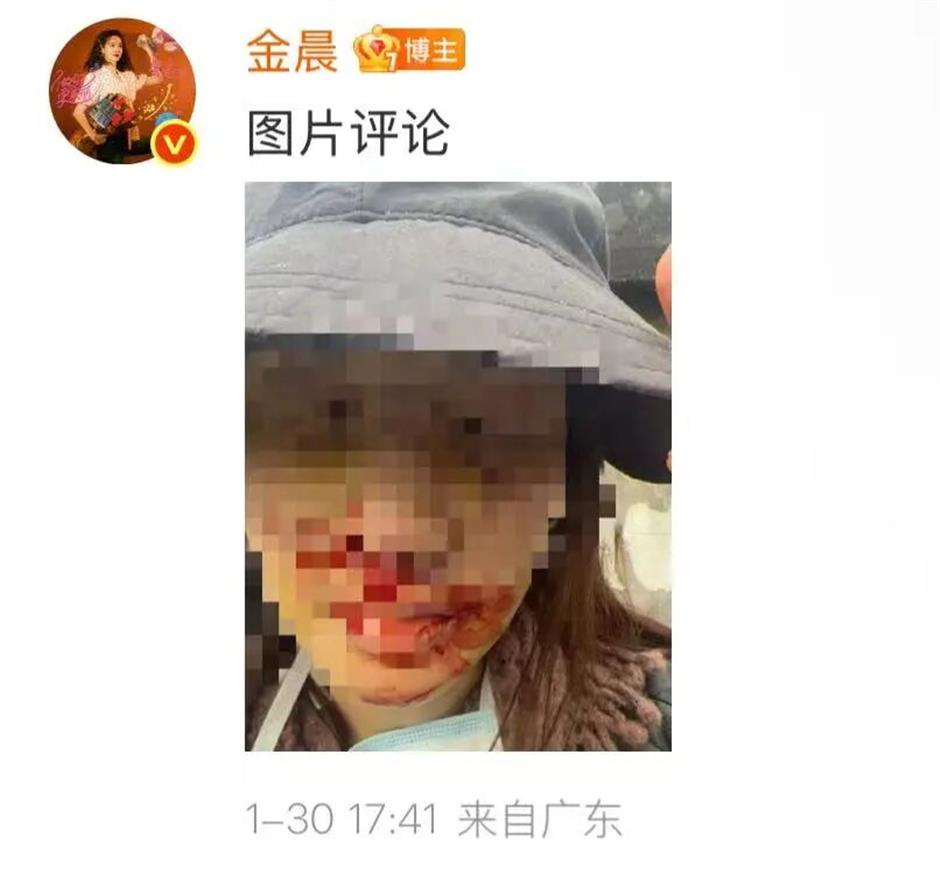 Actress Jin Chen apologizes for 'fake driver' in car crash