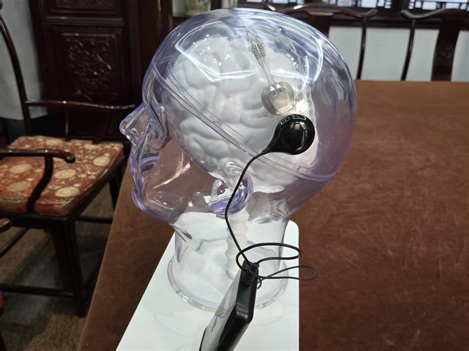 [Big News] SH Just Made Medical History w/Brain-Chip Interface