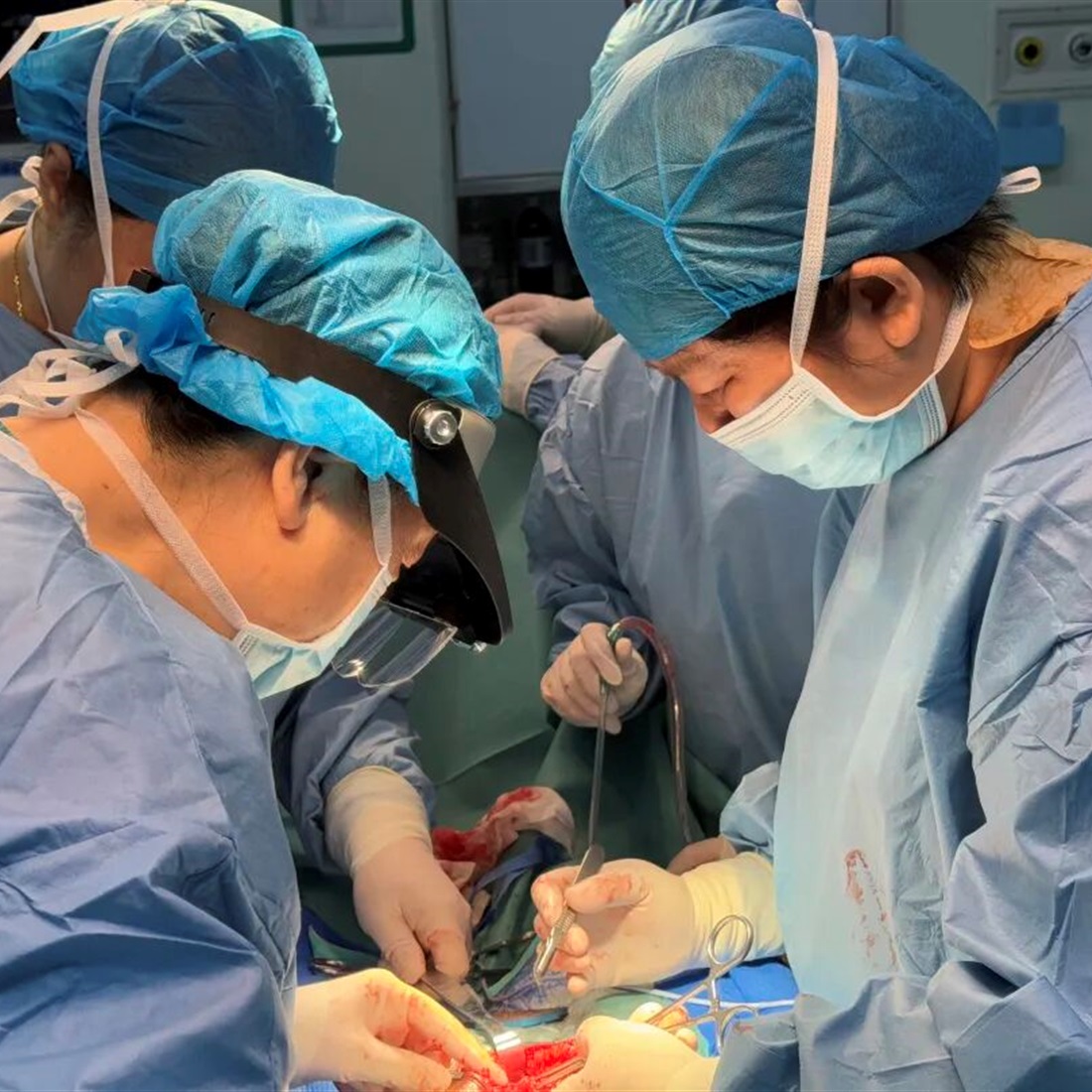 US Woman Advised Hysterectomy Keeps Fertility After Surgeons Remove 656 Fibroids in Shenzhen