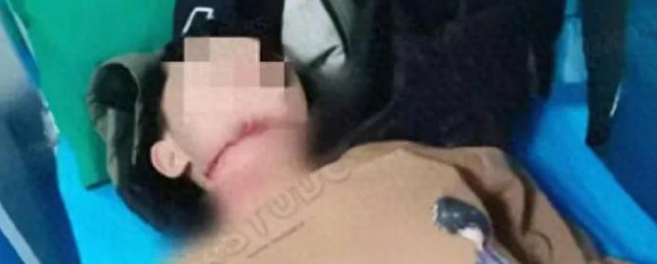 Boy Seriously Injured by Roadside Rope in China, Suspect 'Under Criminal Measures'