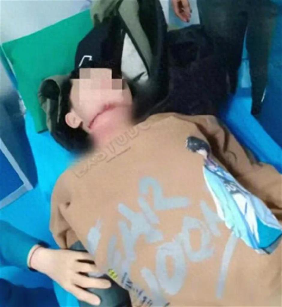 Boy Seriously Injured by Roadside Rope in China, Suspect 'Under Criminal Measures'