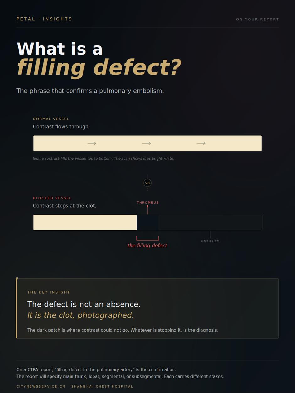 [PETAL Insights] The 10-Second Scan That Finds a Lung Clot