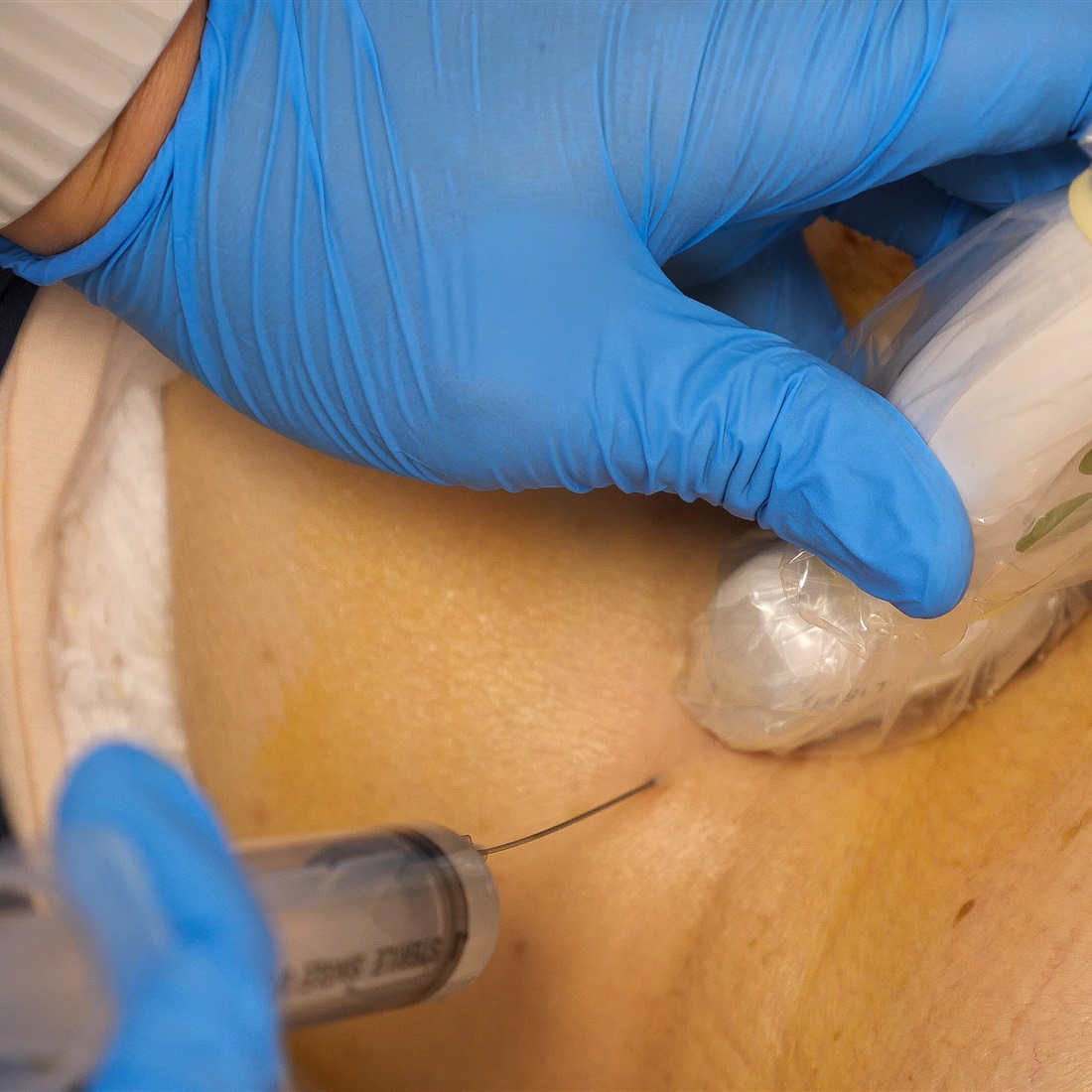 Shanghai Hospital Launches Pioneering Emergency Pain Relief Service