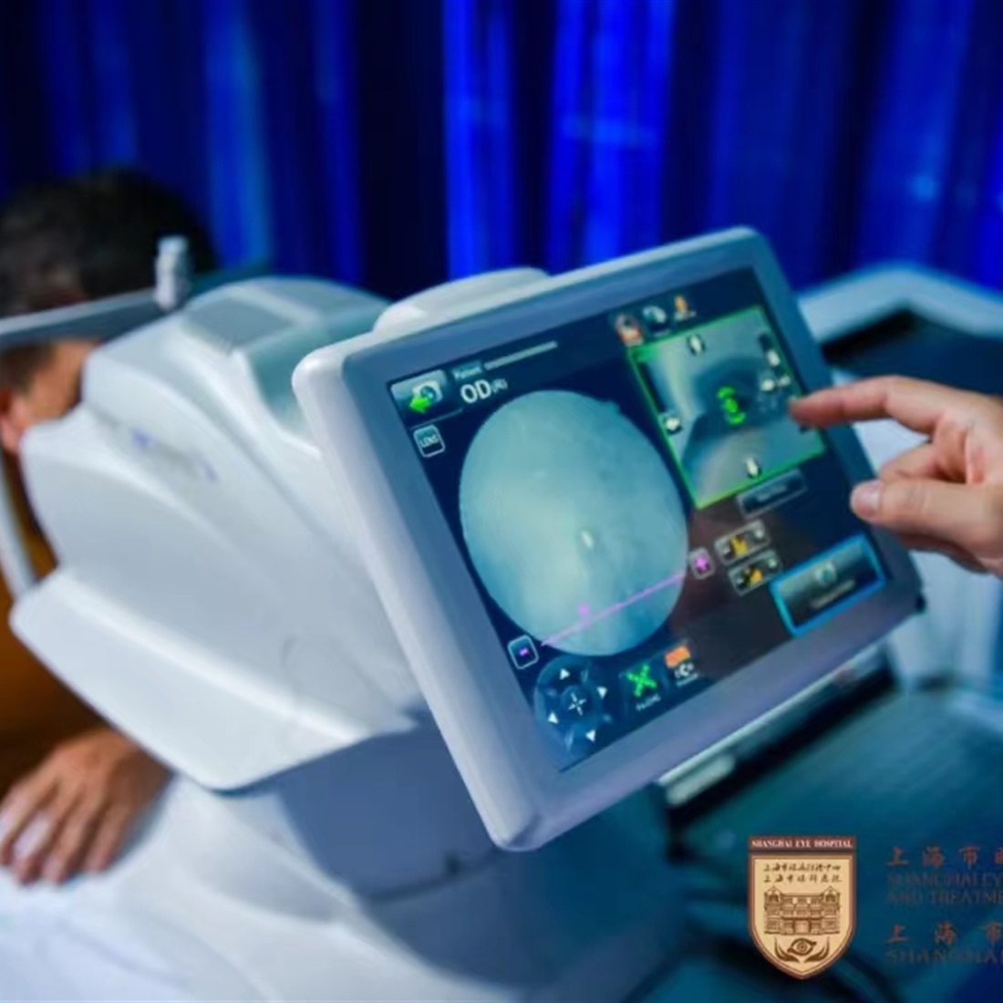 Shanghai Unveils Standardized AI-Driven Eye Care Services