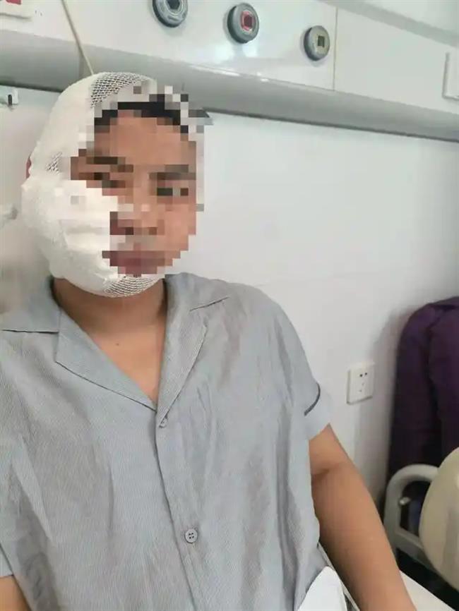 Man Bitten by Shark While Diving at Changsha Ocean Park