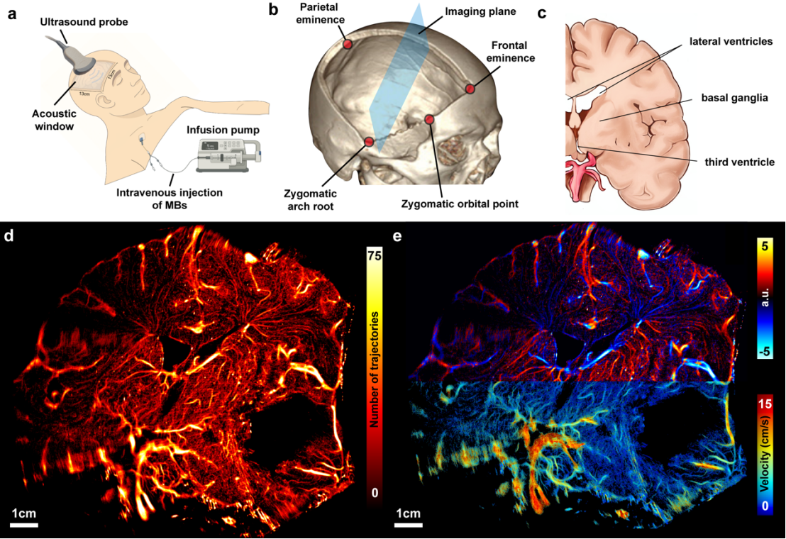 [China Tech] Shanghai Scientists Create Bedside Brain Imaging System ...