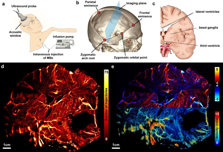 [China Tech] Shanghai Scientists Create Bedside Brain Imaging System for Severe Head Injuries