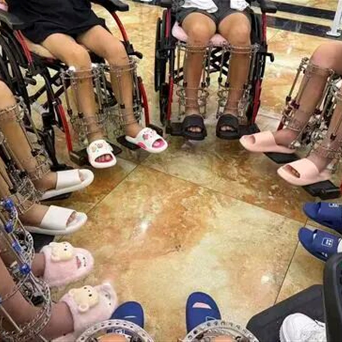 China's Banned Leg-lengthening Surgery Fuels Underground Broker Network