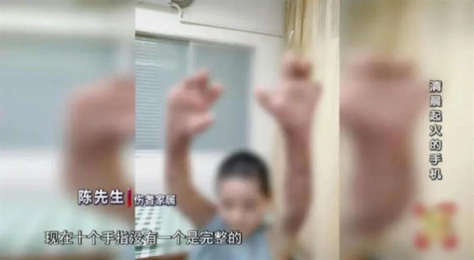 Court Orders Phone Seller to Pay 630,000 Yuan After Charging Fire Severely Burns Woman