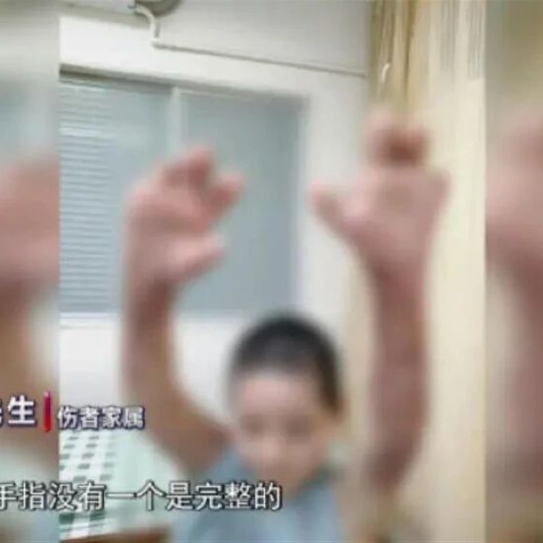 Court Orders Phone Seller to Pay 630,000 Yuan After Charging Fire Severely Burns Woman