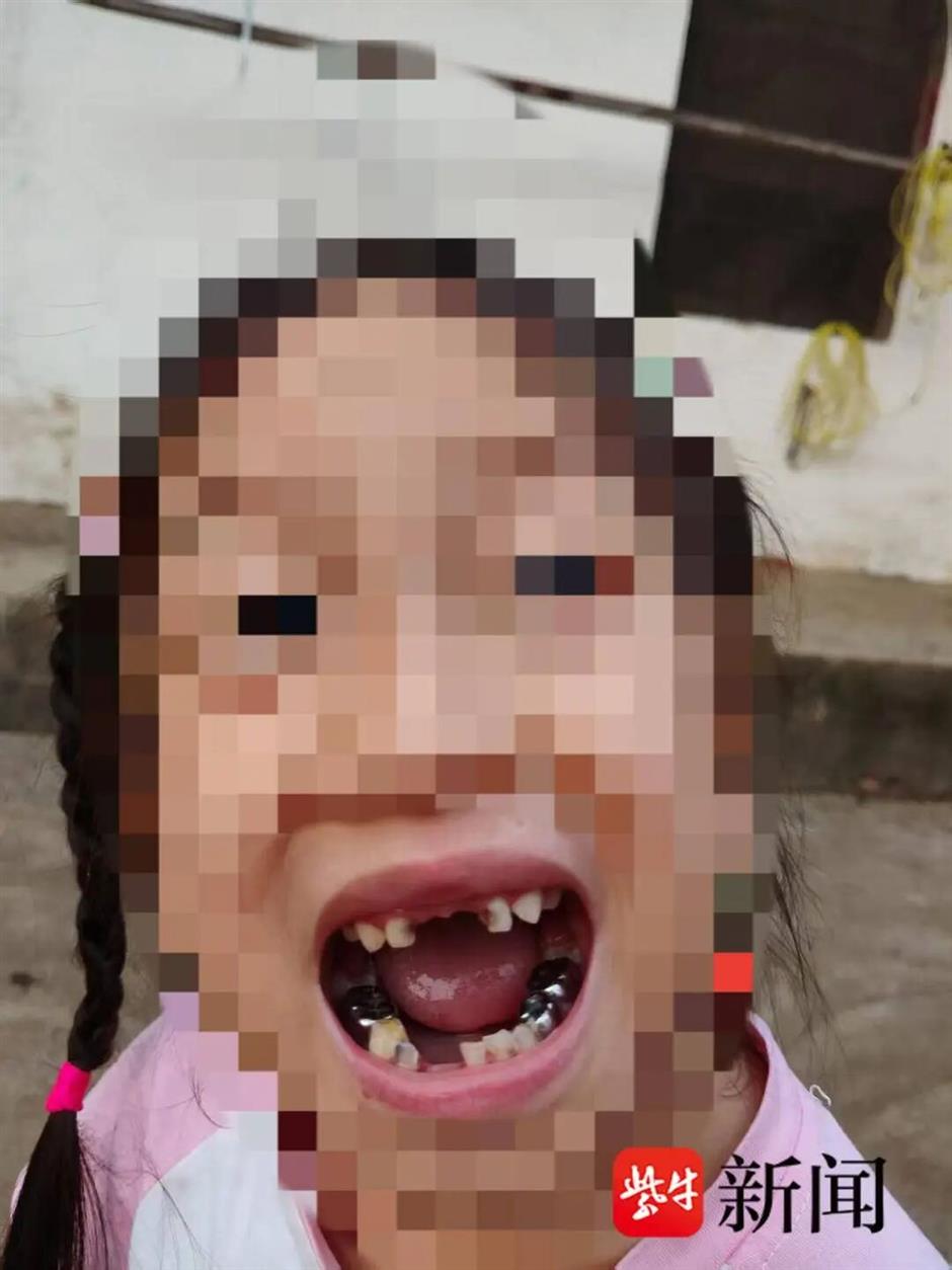 5-Year-Old Girl Loses 4 Teeth After Robot Kicks Her at Hubei Science Museum