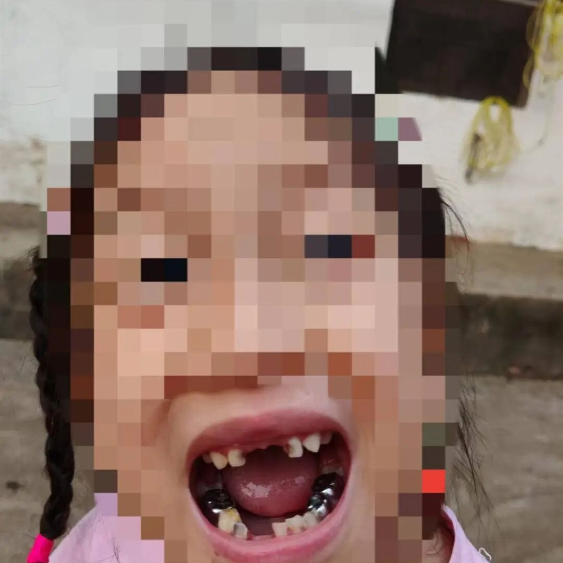5-Year-Old Girl Loses 4 Teeth After Robot Kicks Her at Hubei Science Museum